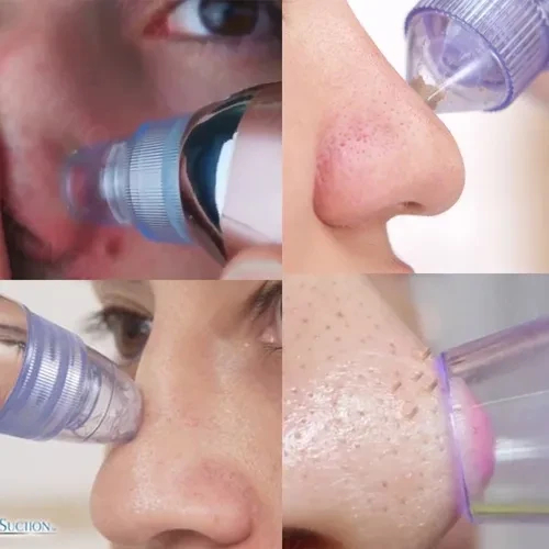 EXTRACTOR DE ESPINILLAS XN-8030