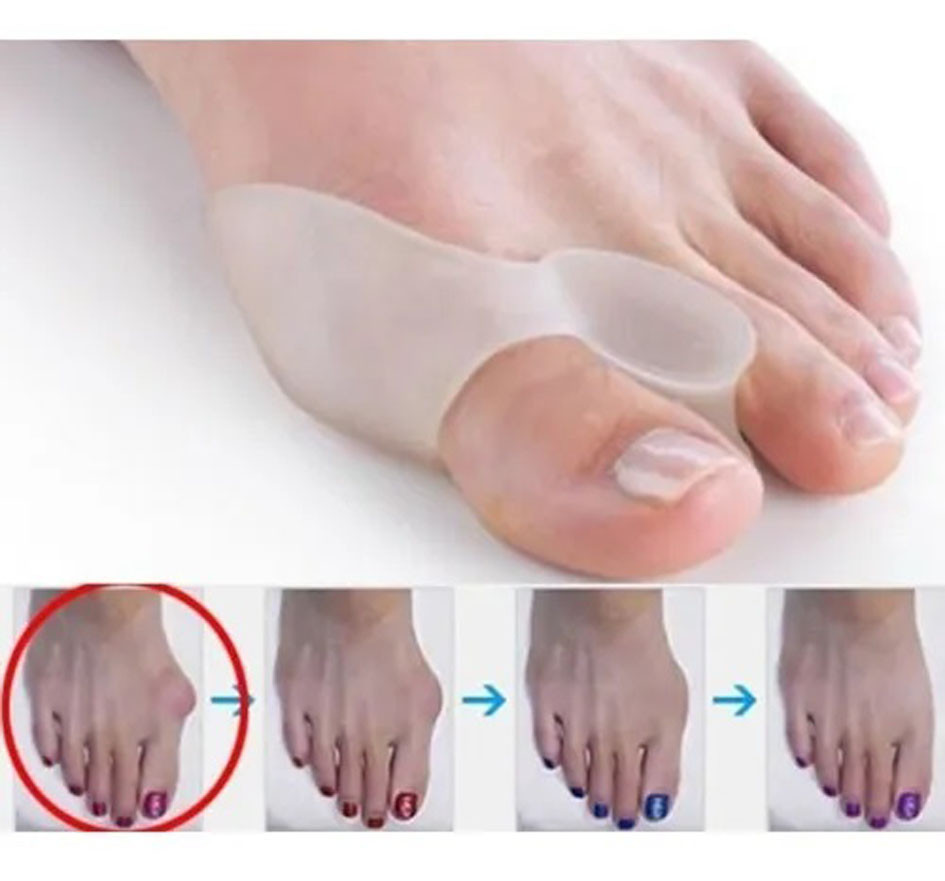 2 Corrector Separador Silicona Desviacio - Imagen 3