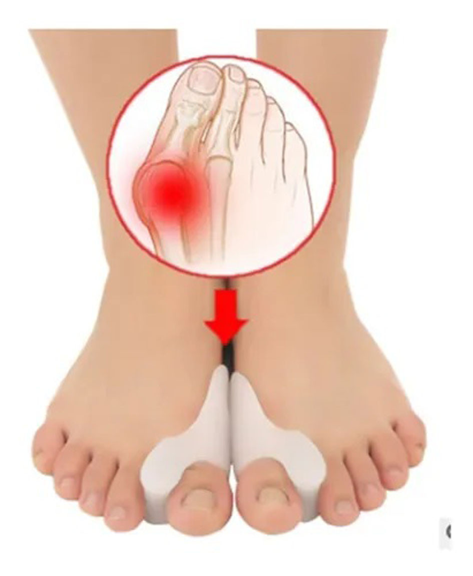 2 Corrector Separador Silicona Desviacio - Imagen 4