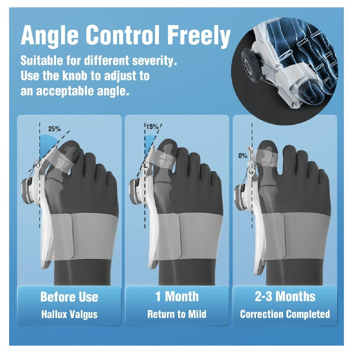 corrector de juanetes caja blanca