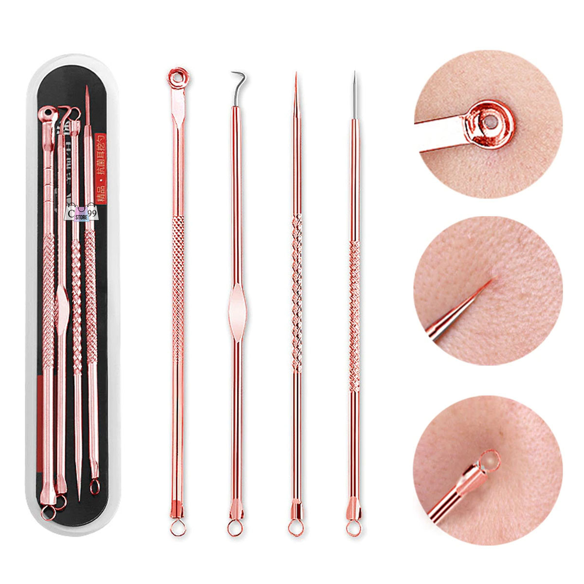 Agujas Para eliminar el acné o Puntos Ne