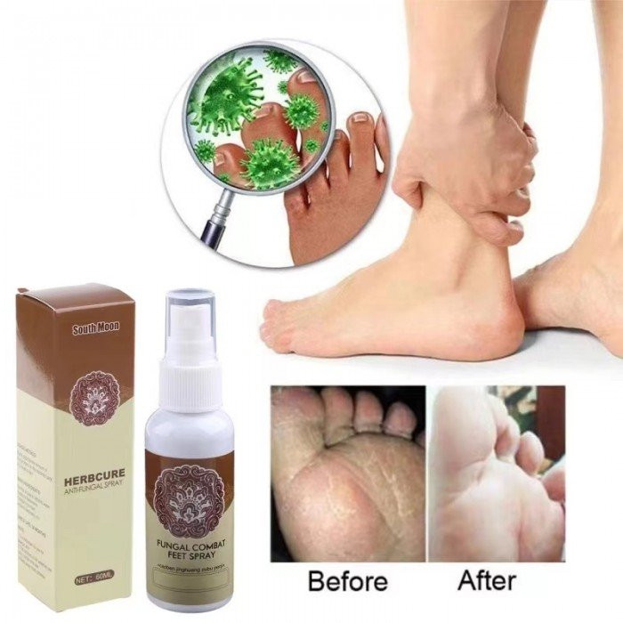 HERBACURE HERBAL ANTI HONGOS