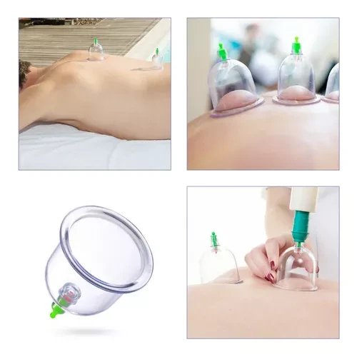 VACUMTERAPIA 12 PIEZAS