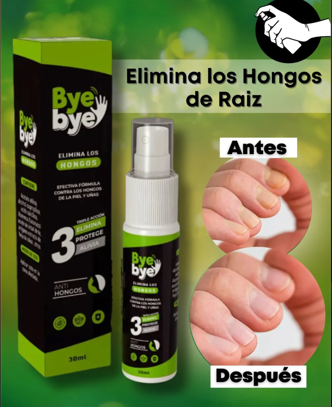 🔝ByeBye Hongos → ELIMINADOR DE HONGOS