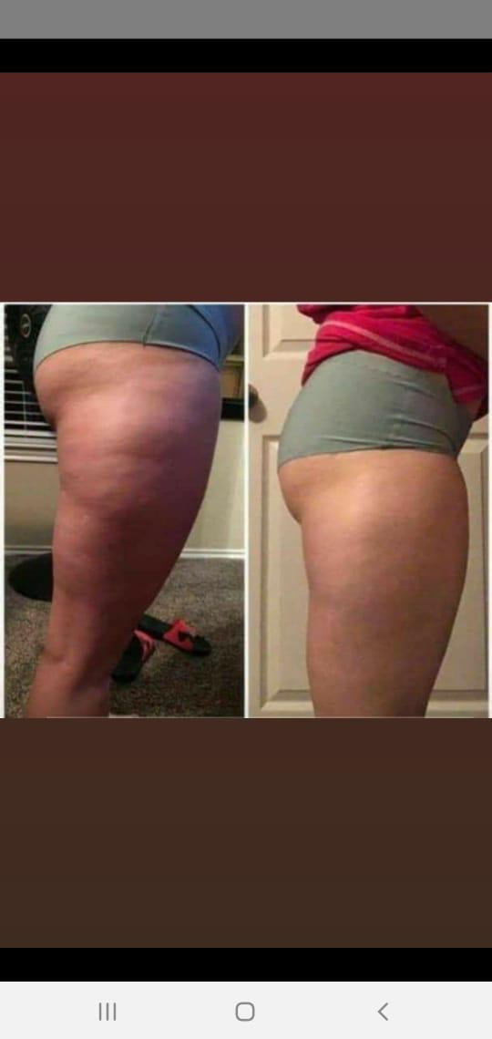 Gel Corps / Cryoactive Gel - Imagen 10