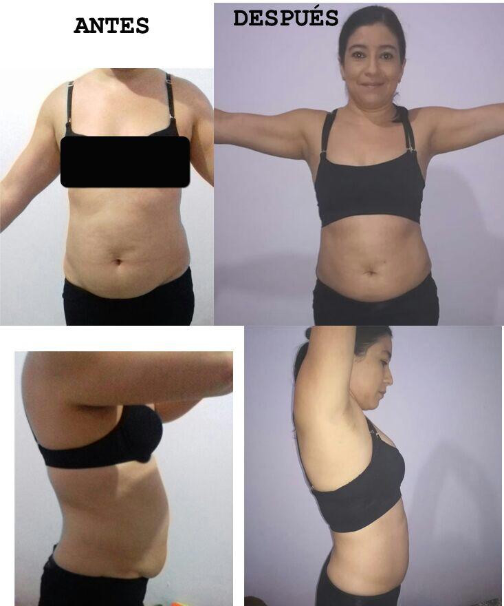 Gel Corps / Cryoactive Gel - Imagen 13