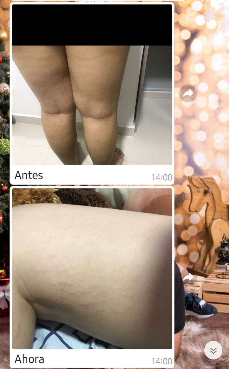 Gel Corps / Cryoactive Gel - Imagen 18