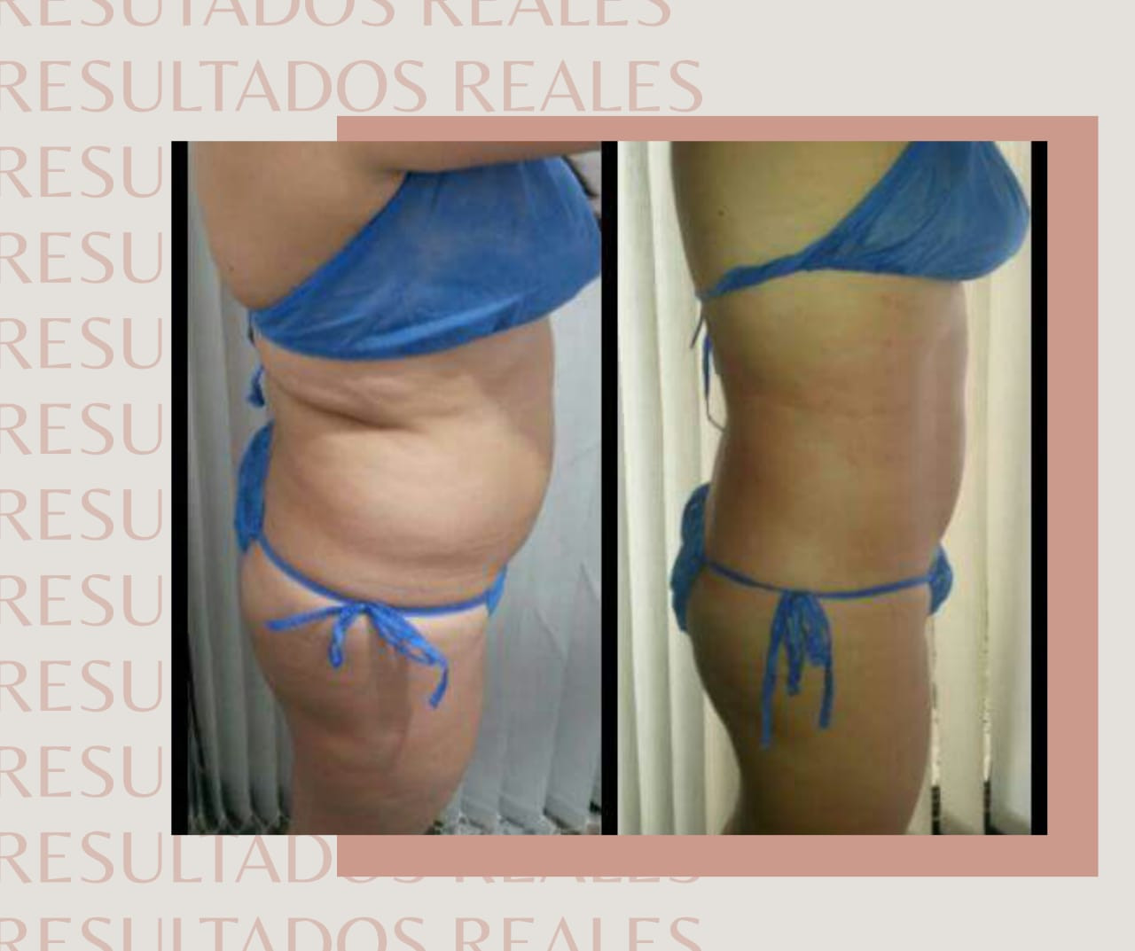 Gel Corps / Cryoactive Gel - Imagen 19