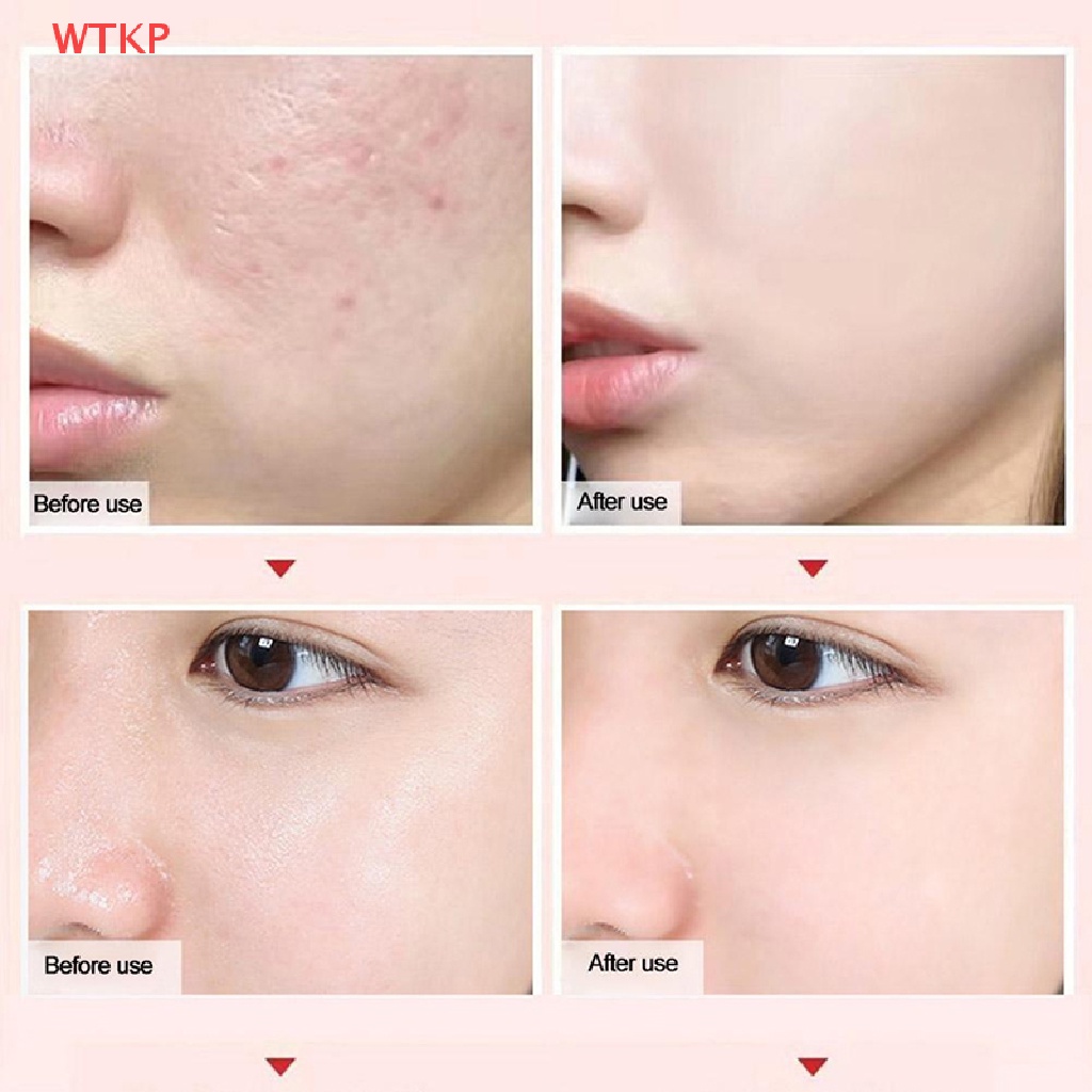 BARRA POROS INVISIBLE NICOR - BIOTEZ