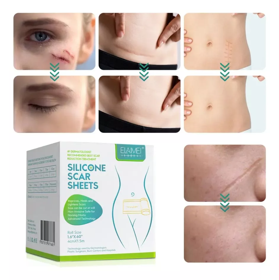 Cinta Para Quitar Cicatrices