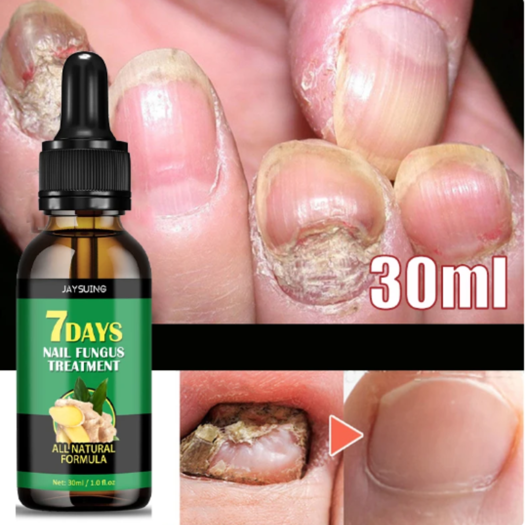 Aceite Jengibre Uñas