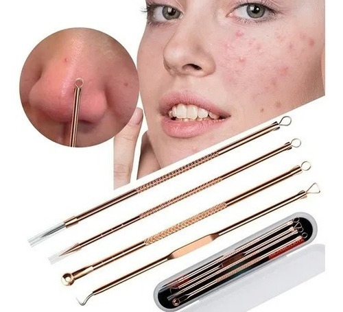 Extractor De Espinillas Removedor Acne
