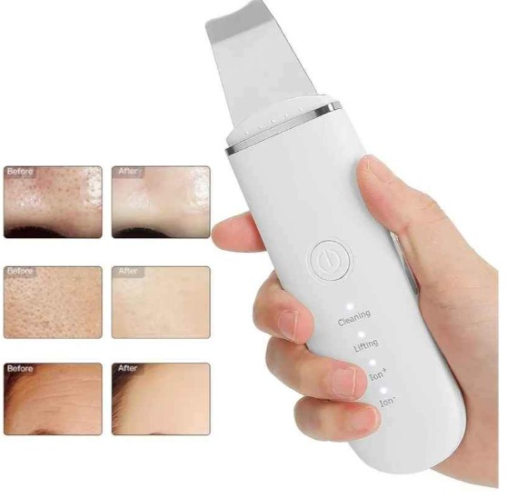 Limpiador Facial Ultrasonico