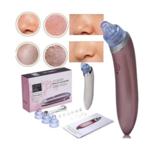Extractor de Puntos negros