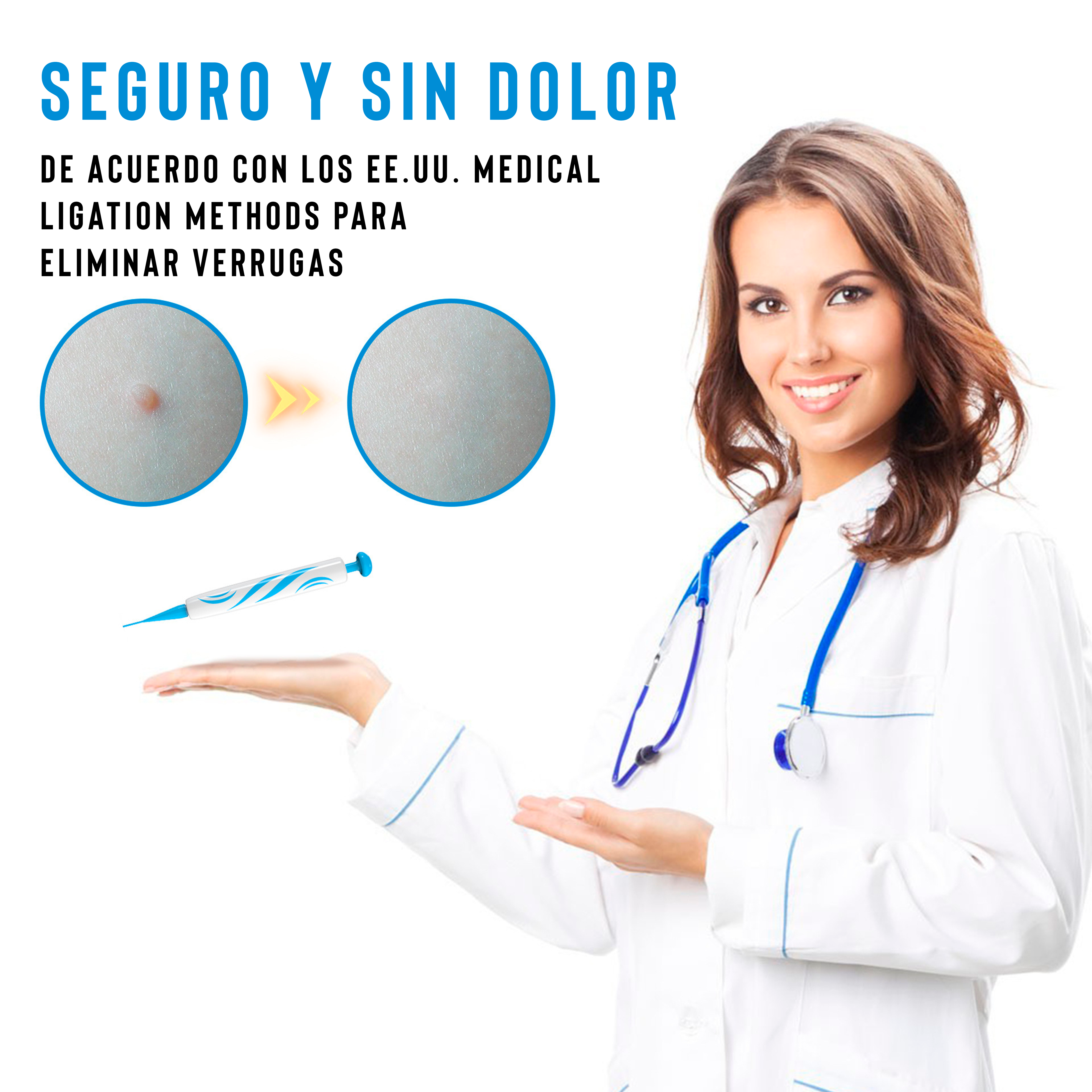 Kit Removedor de Verrugas Sin Dolor - Imagen 2