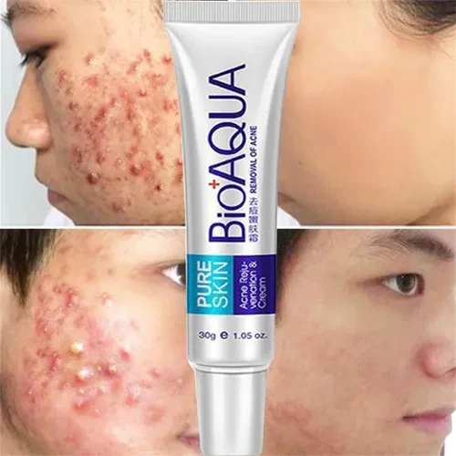 CREMA ANTIACNE BIOAQUA - BIOTEZ