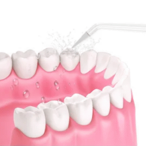 Irrigador Bucal 4 puntas