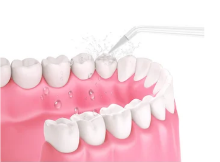 Irrigador Bucal 4 puntas