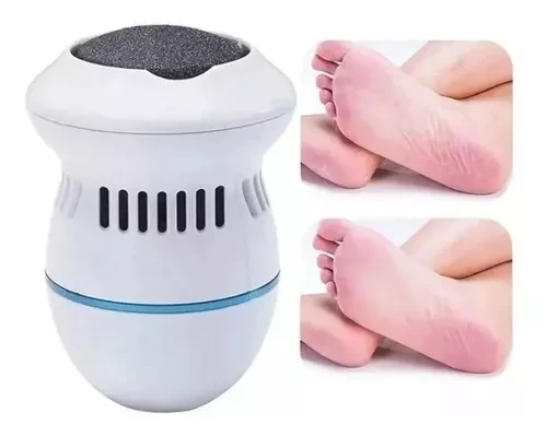 🦶LIMA QUITA CALLOS INALAMBRICO✨ - Imagen 2