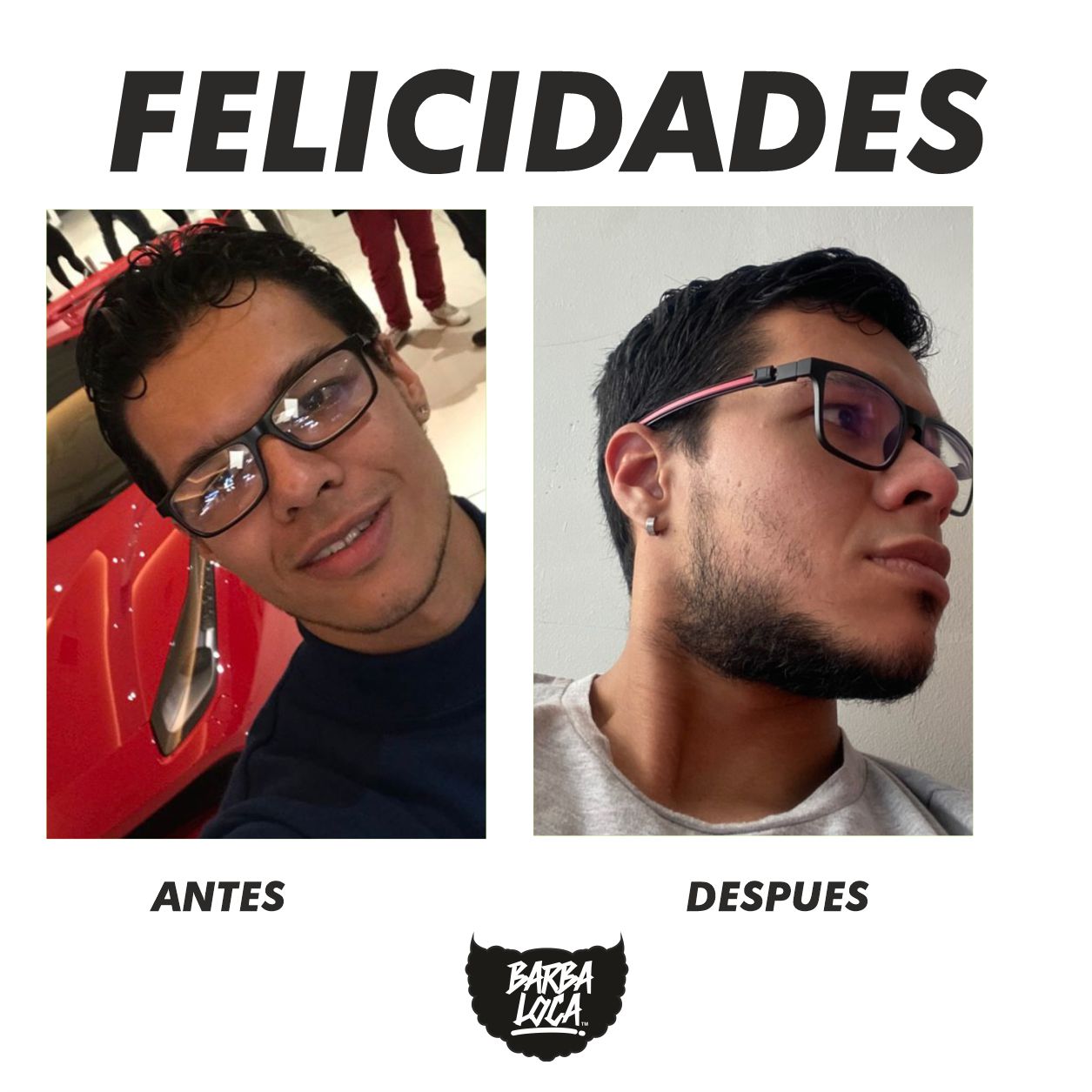KIT COMPLETO ACTIVADOR BARBA LOCA